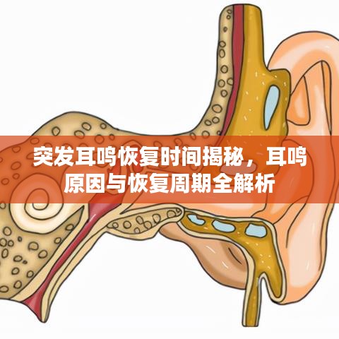 突发耳鸣恢复时间揭秘，耳鸣原因与恢复周期全解析